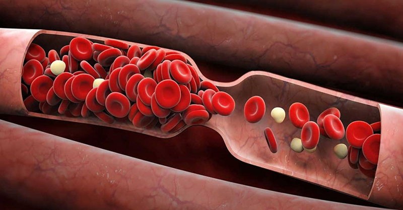 problèmes vasculaires